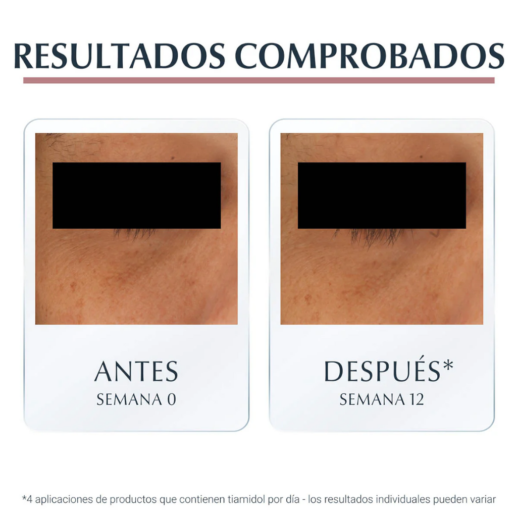 Eucerin Anti-pigment crema facial anti-ojeras 15ml
